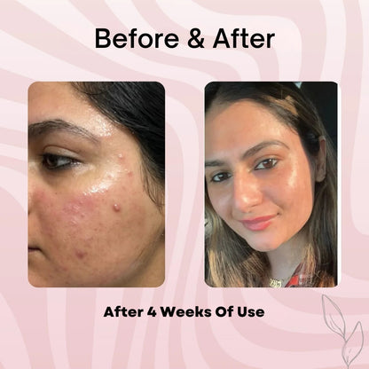 Medicure Collagen Overnight Wrapping Peel Off Facial Mask Pack of 1