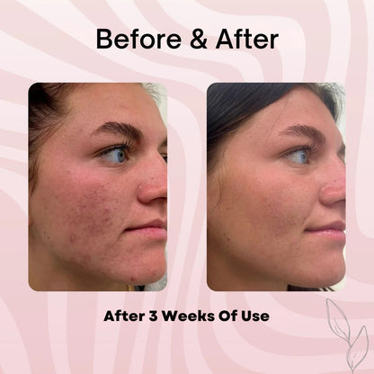 Medicure Collagen Overnight Wrapping Peel Off Facial Mask Pack of 1